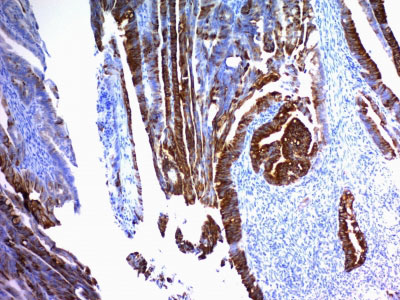 IHC -  MUC2 (Mucin 2) Antibody - With BSA and Azide AH10605-20